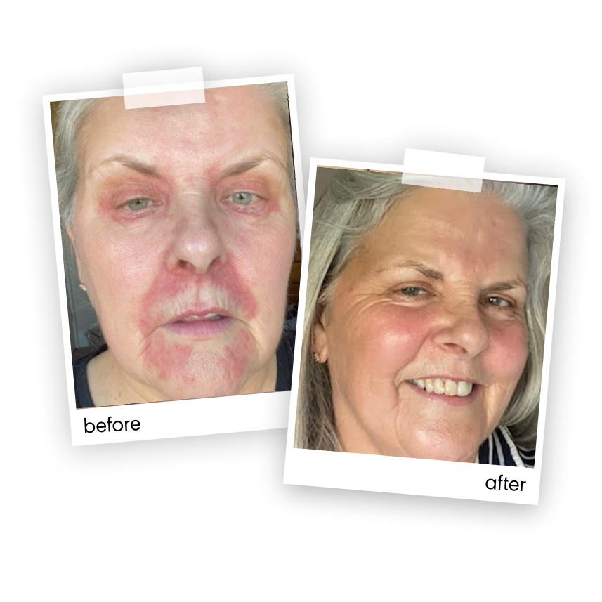 Caroline’s before and after photographs using Made Of More