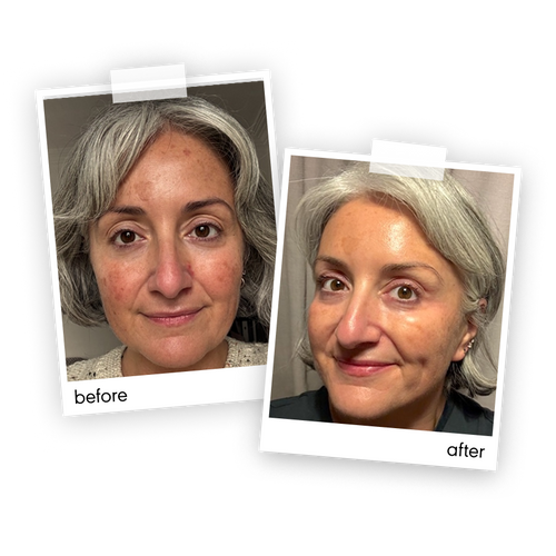 “I like how calming the products are. They are really gentle on my skin and don’t cause any irritation and are even making a  difference to my dark spots.”