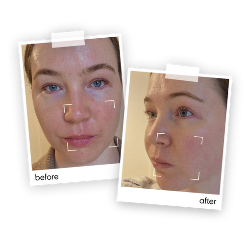 “My skin feels more hydrated and generally healthier. Even when my skin doesn’t look dramatically different, it feels more comfortable and less irritated.  The rescue balm is amazing especially with the  change in weather"