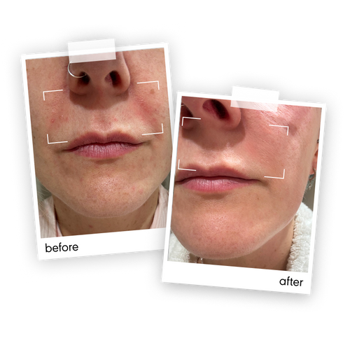 “Even though I was ill and didn't use the products as consistently as I’d planned, my skin feels a lot less dry and more hydrated. My skin feels softer, calmer and more comfortable, and a definite reduction in redness in the periodontal area when I use Made Of More.”