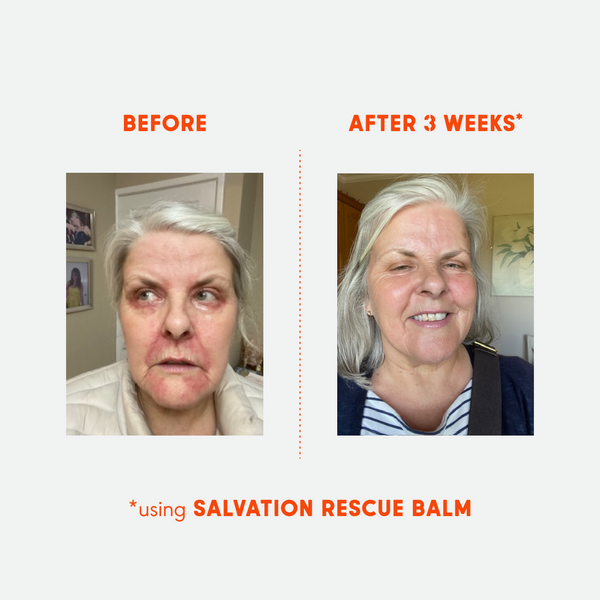 SALVATION. Rescue Balm